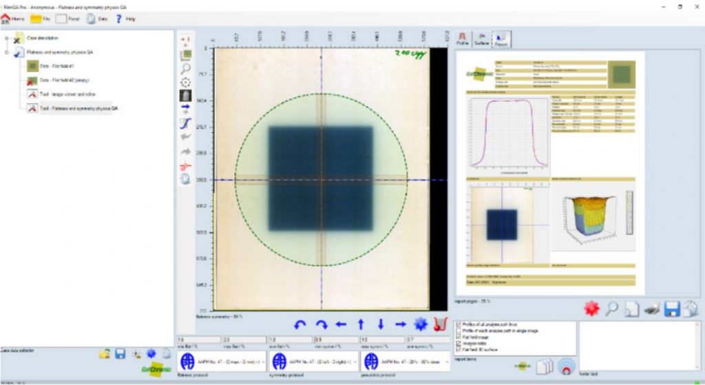 Ashland-filmqa-pro-software-v7_PEO-Medical