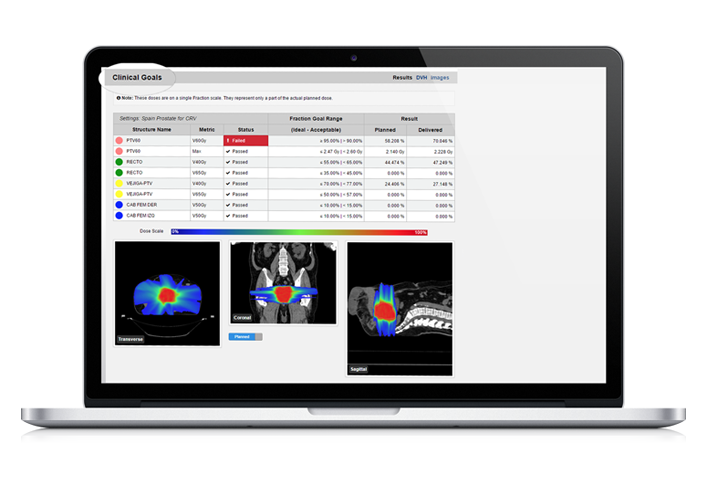 DoseCHECK platform shown on a computer screen