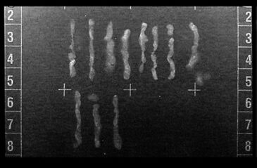 Radiography of Multiple core specimens made with help of GRID-VIEW