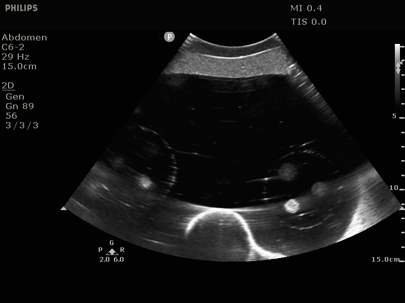 Ultrasound of the model 071B